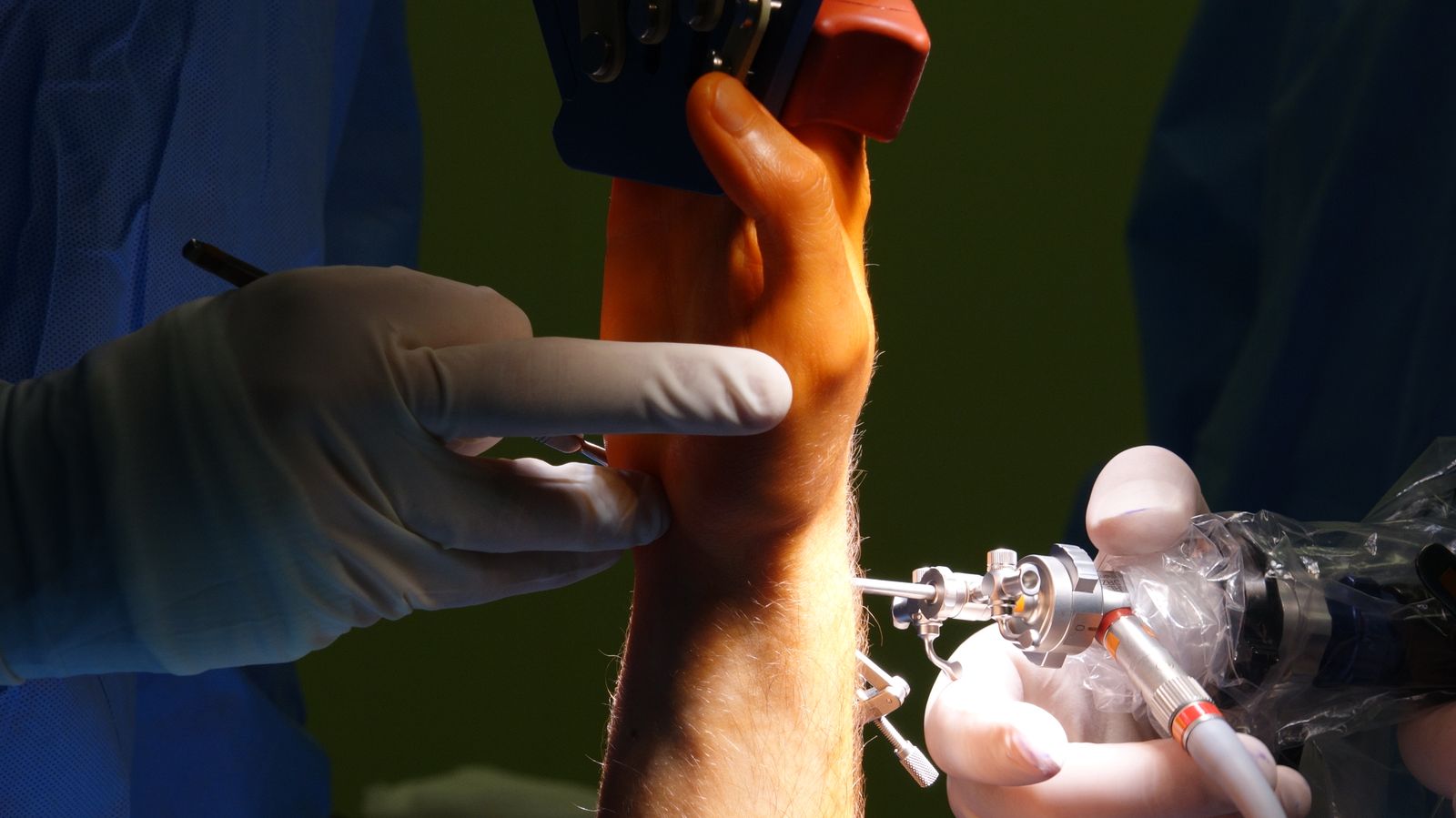 Precision Wrist Surgery in Operating Room